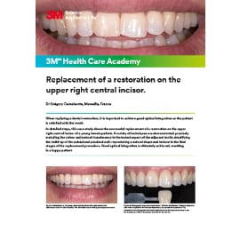 Replacement of a restoration on the upper right central incisor clinical case cover